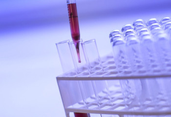 Қазақстандықтар қандай тегін скринингтерден өте алады?