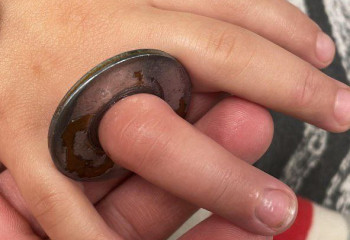 Атырауда 5 жасар баланың саусағы шайбаға қысылып қалған