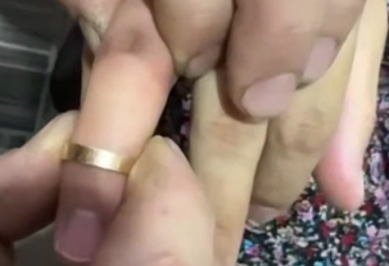 Спасатели МЧС помогли женщине снять застрявшее кольцо