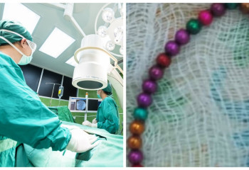 «39 шарик жұтып қойған». Көкшетауда дәрігерлер төрт жасар баланы аман алып қалды