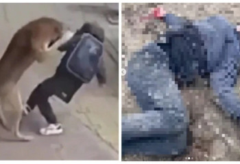 Маңғыстауда ит талаған жасөспірімнің жағдайы белгілі болды