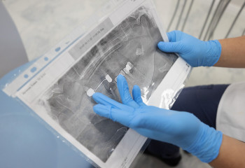 Женщина откусила донер «с сюрпризом» в Актобе и лишилась зуба