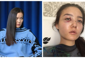 «Балама ота керек». Дипломат күйеуінен қорлық көрген Карина Мамаштың жағдайы қалай