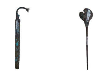 Орта ғасырда да адамға ота жасалғаны анықталды