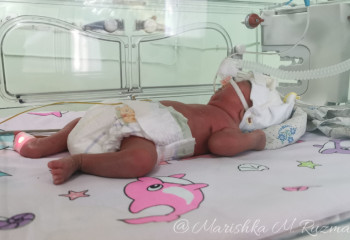 В Казахстане родителям могут разрешить находиться с детьми в реанимации