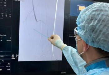 Шымкентте дәрігерлер шетелдік азаматты аман алып қалды