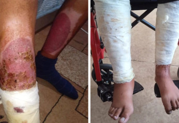 Қарағандыда жасөспірім 14 жастағы баланы өртеп жіберген