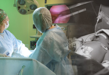 Мыңдаған сәби өмірге келмей шетінейді: Ана мен бала өмірін қалай сақтаймыз?