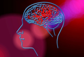 50 жасқа дейінгі инсульт қаупін арттыратын негізгі факторлар анықталды