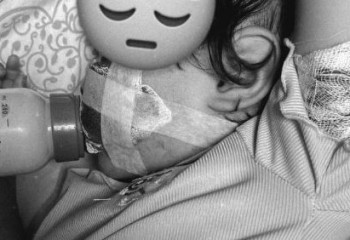 Шиеліде балабақша тәрбиеленушісі қатарласын 25 жерінен тістеп тастаған