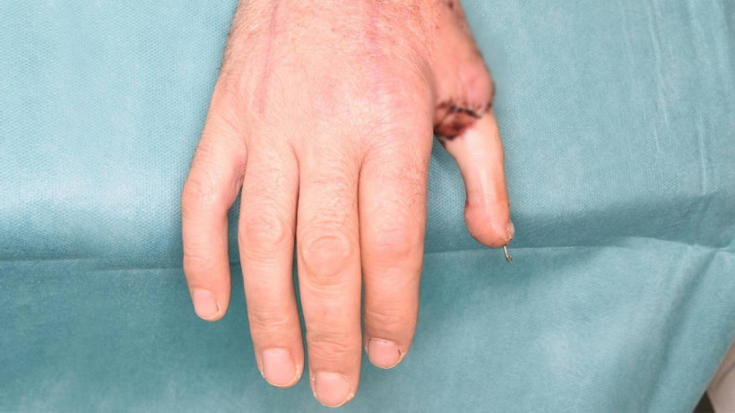  Landeskrankenhaus Feldkirch 