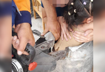 Опасные игры: пятилетняя девочка застряла в жестяной фляге