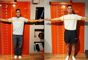 Немец увеличил рост со 171 до 195 см — теперь это его боль и триумф