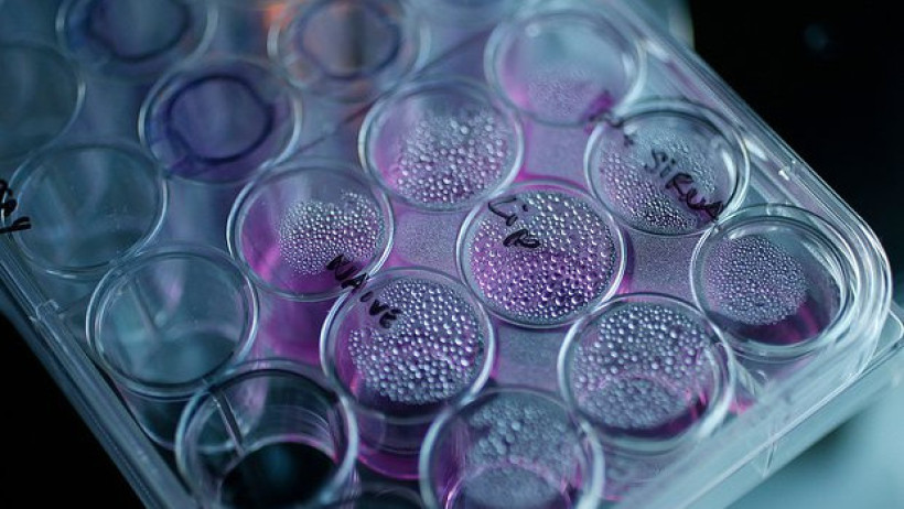  Suzanne Plunkett / Reuters 