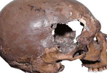 В Италии найден древнейший в Европе пример искусственной деформации черепа