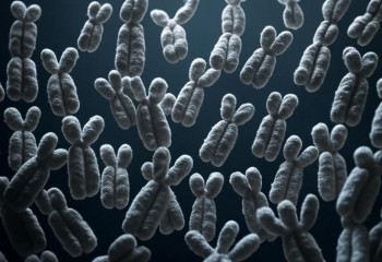 Учёные нашли способ удалить лишнюю хромосому при синдроме Дауна