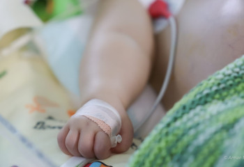 Индийские хирурги провели уникальную операцию грудному ребенку