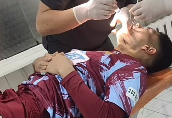 Фото Темирлана Анарбекова, сломавшего челюсть, появилось в соцсетях