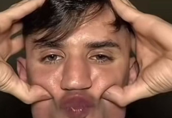 Скуловая растяжка превращает всех в красавцев: правда или миф