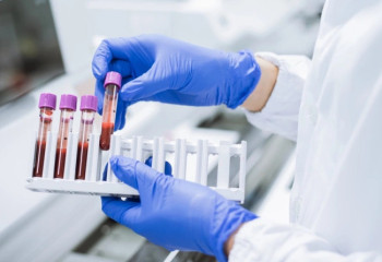 Ғалымдар қатерлі ісікті 10 жыл бұрын анықтайтын тест әзірледі