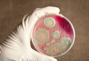 Алматы облысында сібір жарасы көмілімі табылды