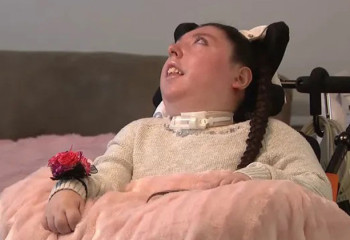 «Дәрігерлер оны өледі деген»: мисыз туған қыз 20 жасқа толды