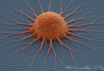 Australia unveils MRI tech that freezes tumors without surgery