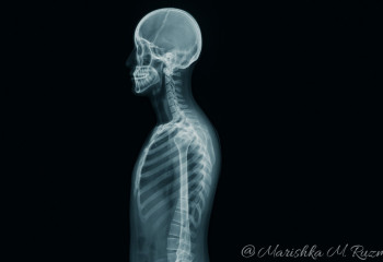 Без имплантов и хирургии: разработан гель, запускающий рост нового хряща