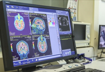 Norway introduces blood test to detect Alzheimer’s brain changes