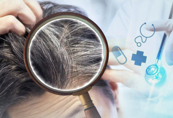 Жастардың шашы неге ерте ағарады? Маман түсіндірді