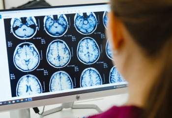 Паркинсон ауруы: «Дірілдеген сал» дерті туралы не білуіміз керек?