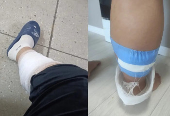 Көкшетауда аяғы ауыр әйелді бұралқы иттер қапқан: құрсақтағы сәбиге қалай әсер етеді?