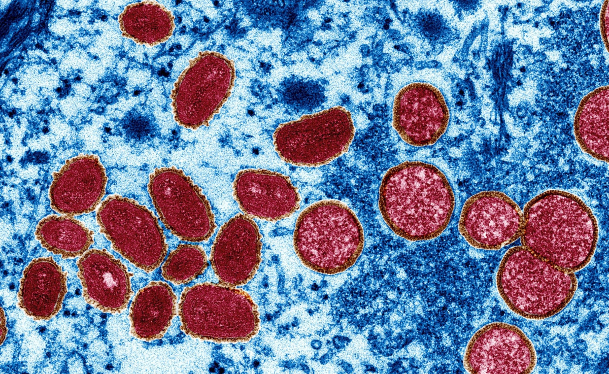 Фото:&nbsp;cdc.gov