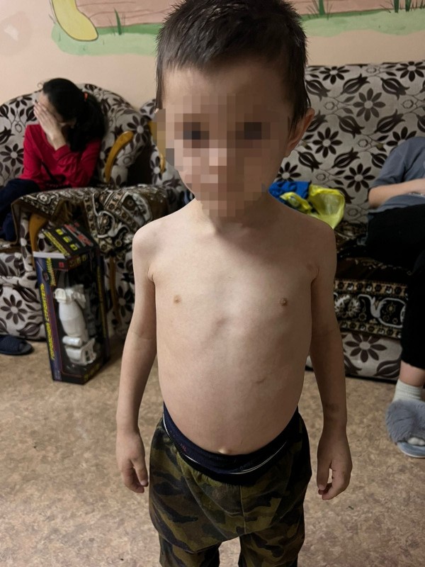 Кокшетауская полиция расследует жестокое обращение с пятилетним мальчиком