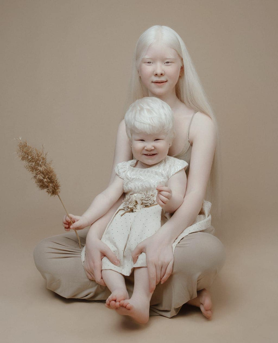 Девушка-альбинос из Актау стала брюнеткой и поразила казахстанцев