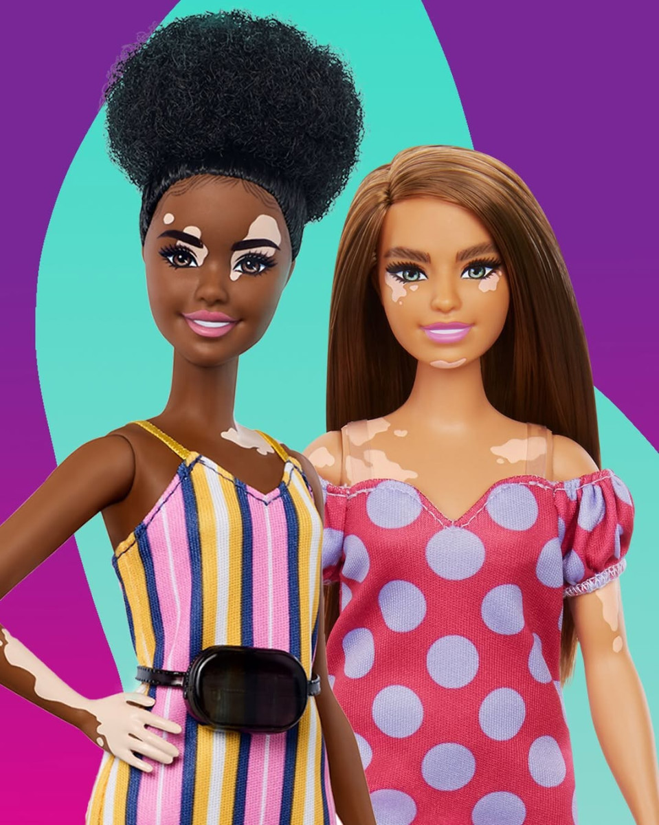 Барби с диабетом первого типа: инклюзивность в мире игрушек Барби с диабетом первого типа: инклюзивность в мире игрушек