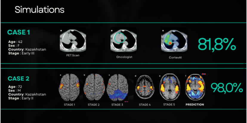 Қатерлі ісікті 3 минутта анықтайды: 17 жастағы студент әлемді қалай мойындатты