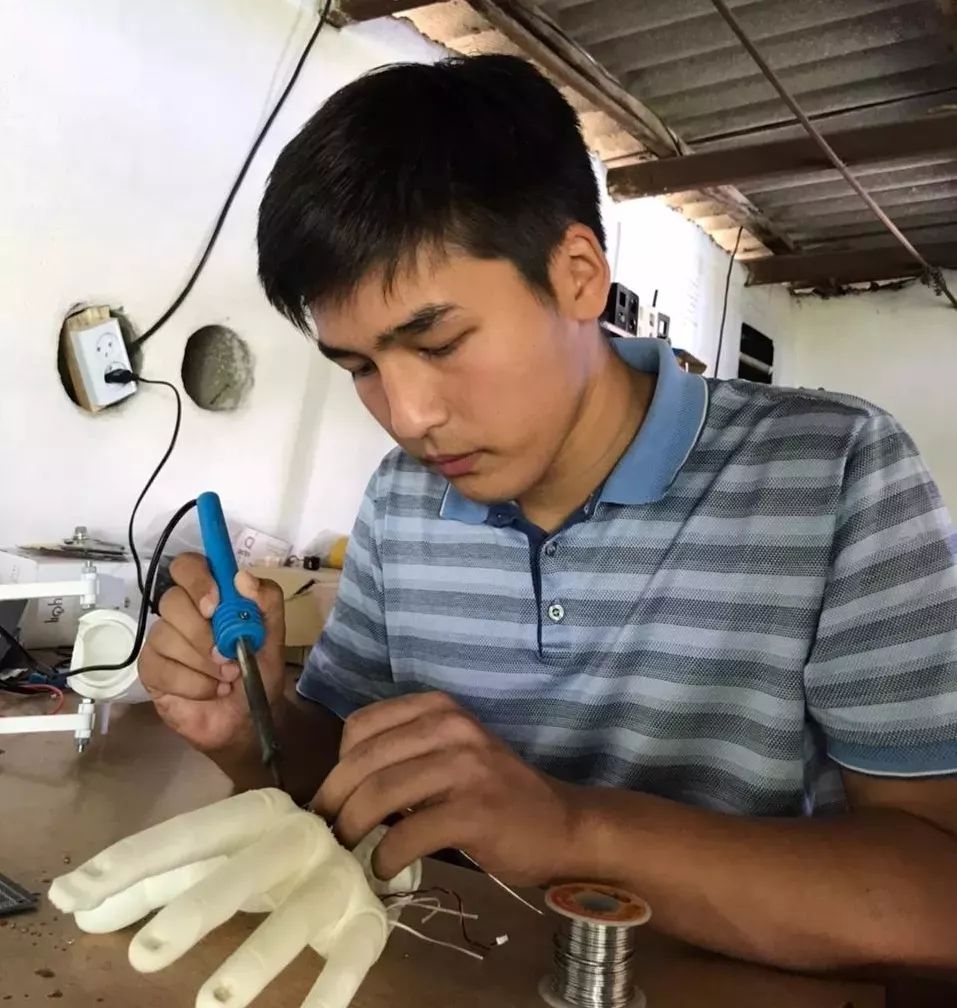 Казахстанский разработчик бионических протезов обратился за помощью к казахстанцам