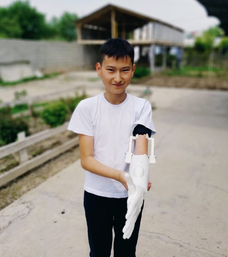 Казахстанский разработчик бионических протезов обратился за помощью к казахстанцам