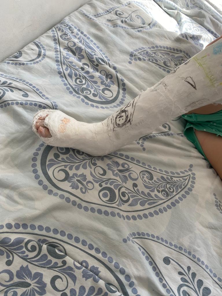 Уникальные совместные операции 8 казахстанским детям с редкими патологиями ног и рук провели врачи Алматы и Ярославля